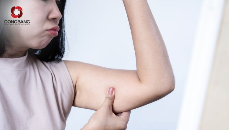 Có nhiều nguyên nhân gây ra mỡ bắp tay đặc biệt nằm ở chế độ ăn uống