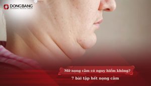 Mỡ nọng cằm có nguy hiểm không? 7 bài tập hết nọng cằm