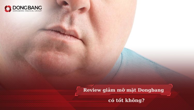 Review giảm mỡ mặt tại Dongbang