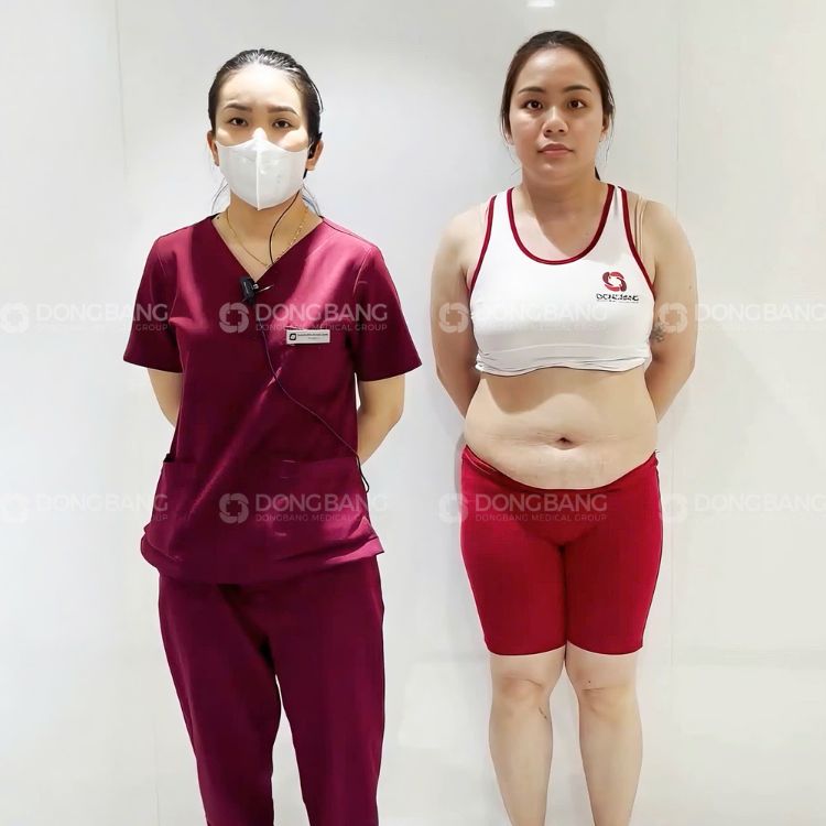 Béo bụng - nỗi ám ảnh sau sinh muôn thở của các bà mẹ
